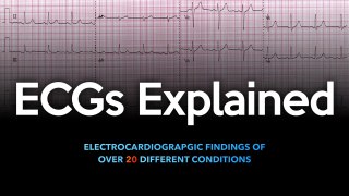 ECG Explained | ই, সি, জি সম্পর্কে বিস্তারিত |