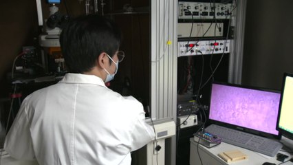 불안장애 새 발병 원인 규명...치료제 개발 단초 / YTN