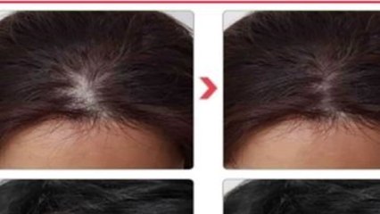 "탈모 예방·치료 샴푸는 없다"...허위광고 무더기 적발 / YTN