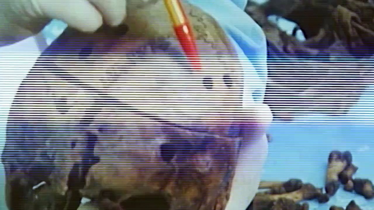 Ivan Milat Der Rucksack-Mörder Staffel 1 Folge 3 HD Deutsch