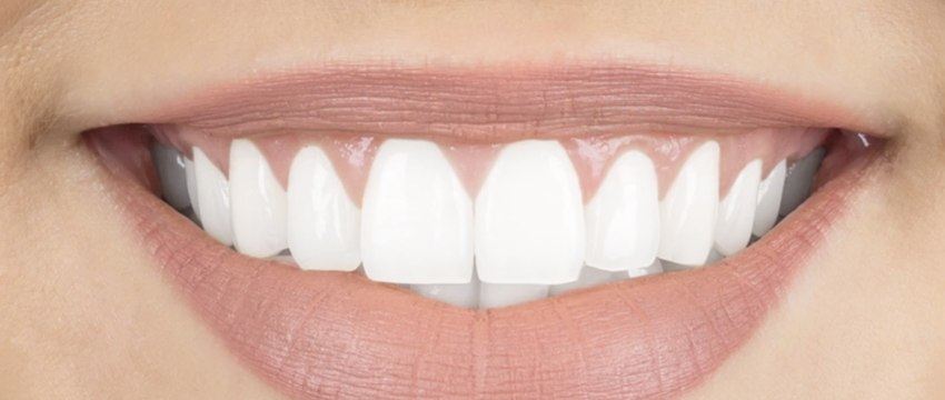 Voici comment blanchir naturellement ses dents à la maison