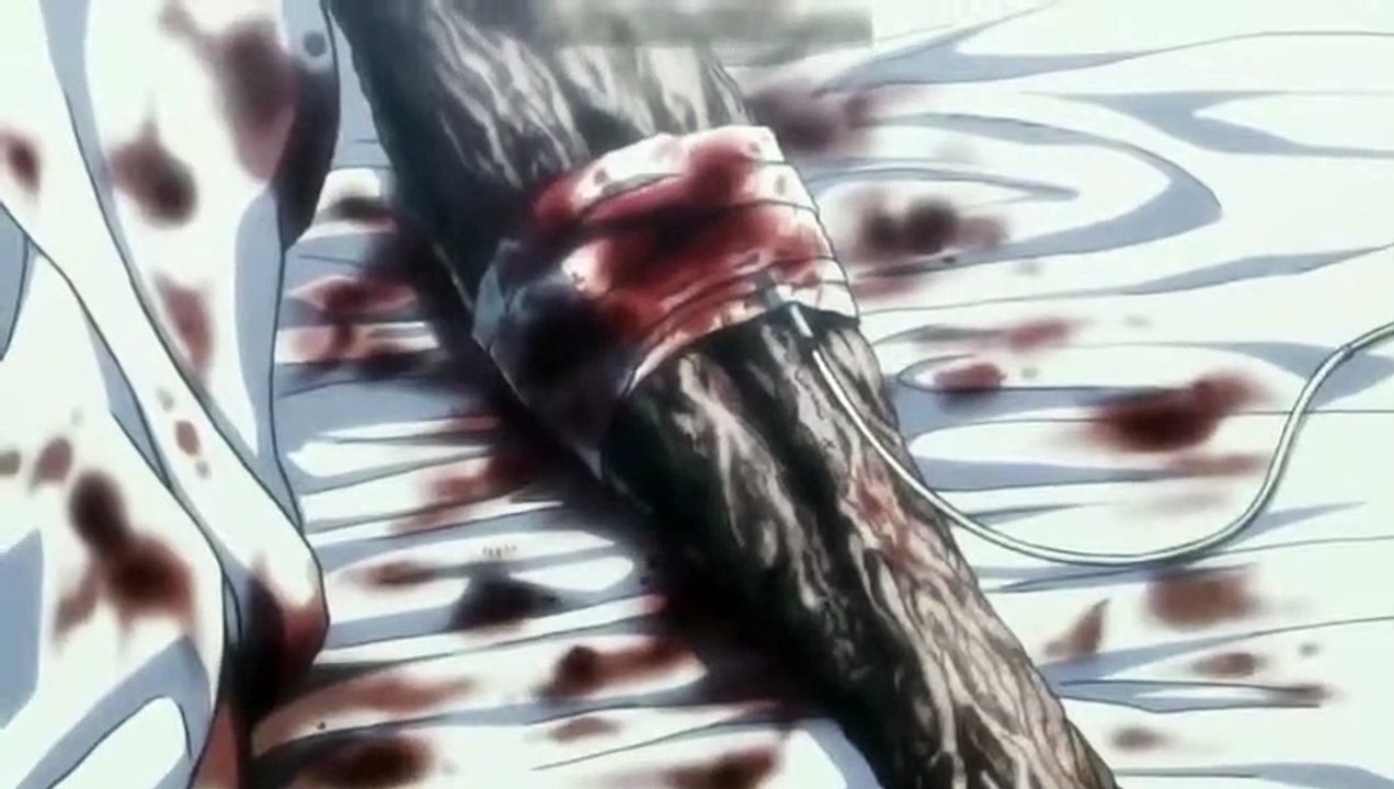 Alluka Heals Gon With Nanika anika al power