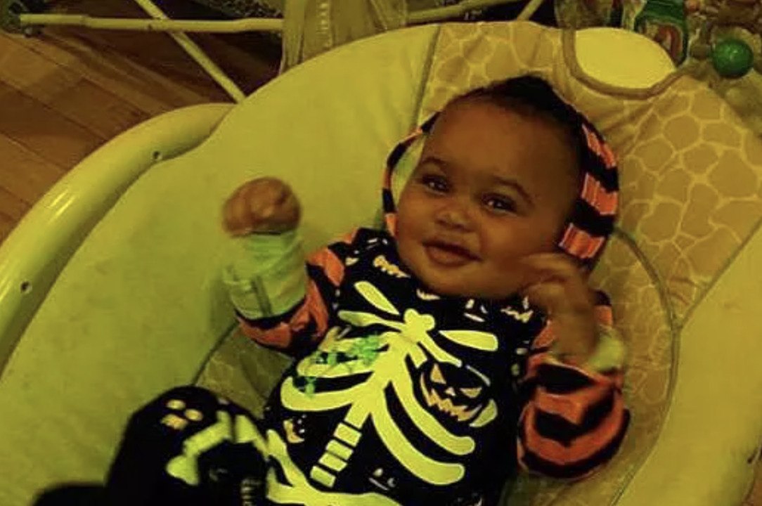 7-Month-Old Boy 'Fighting for His Life' After Being Mauled by Pit Bulls