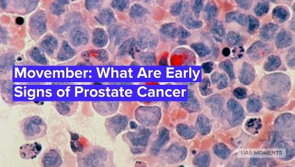 Movemeber: What Are Early Signs of Prostate Cancer