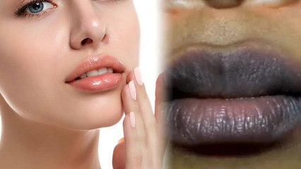 सर्दियों में काले होठों को दूर करने के लिए करें ये उपाय, ऐसे बनाए गुलाबी होठ | Boldsky *Health