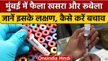 Maharashtra: Mumbai में अचानक फैला Measles, जानें इसके लक्षण और कैसे करें बचाव | वनइंडिया हिंदी*News