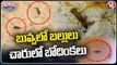 Food Poisoning Cases In 34 Government Hostels In Just 10 Months |  V6 Teenmaar (1)