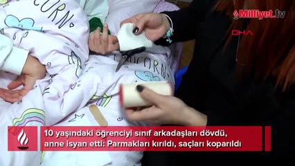 10 yaşındaki öğrenciyi sınıf arkadaşları dövdü, anne isyan etti: Parmakları kırıldı, saçları koparıldı