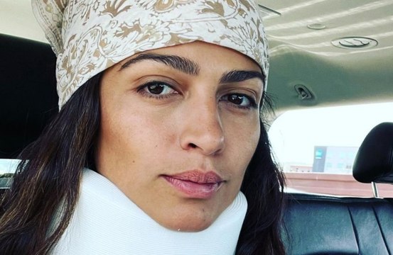 Camila Alves McConaughey: 'A silly fall, turned into not so silly neck situation'