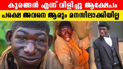 ആക്ഷേപം സഹിക്കവയ്യാതെ കാട്ടിലേക്ക് ഓടി രക്ഷപെട്ടു, മനസാക്ഷി ഇല്ലാത്ത ലോകം | *Viral