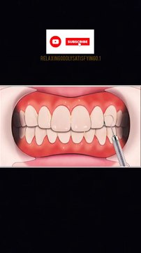 Dental Care Teeth cleaning whiteteeth freshbreath teethcare shorts