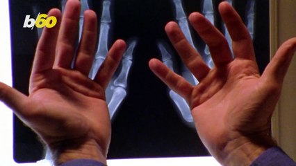 Cracking Your Knuckles - Simple Pleasure or Ultimate Mistake?