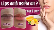 ओठांचा काळपटपणा घालवण्यासाठी करा घरगुती उपाय | How to Lighten Dark Lips | Home Remedy Lighten Lips