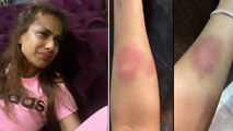 Nia Sharma का रोते-रोते बुरा हाल Video Viral । Boldsky *Entertainment
