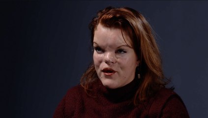 Clémence Bellanger, atteinte de malformations physiques : "Le regard des autres ne me définit pas"