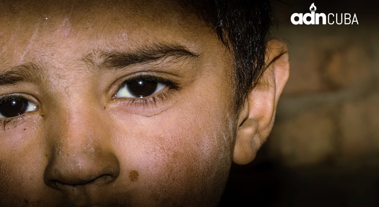 Niños mendigos en Cuba.