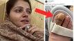 Rubina Dilaik Jhalak Dikhhla Jaa सेट पर हुई घायल, Video Viral।Boldsky*Entertainment