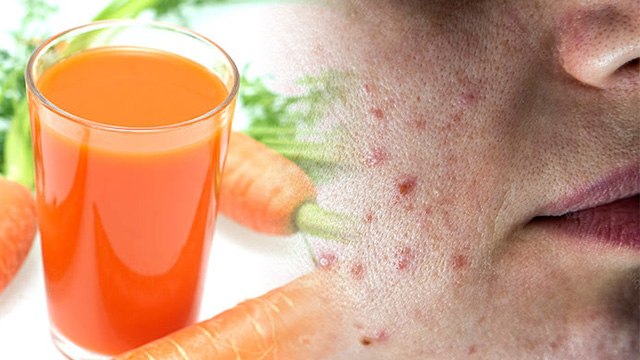 गाजर का जूस पीने से क्या होता है , गाजर का जूस पीने के फायदे जानकर उड़ेंगे होश | Boldsky *Health