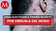 Investigan primer caso sospechoso de muerte por viruela del mono en Jalisco
