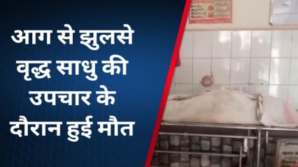 शिवपुरी : धोती में आग लग जानें से बुरी तरह झुलसा वृद्ध,उपचार के दौरान हुई मौत