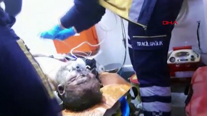 Elinde sigarayla uyudu: Çıkan yangında ağır yaralandı