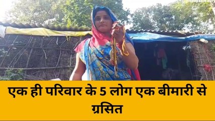 गोण्डा: जन्मजात बीमारी को बच्चों ने दी मात, अलग-अलग क्षेत्रों में दिखा रहे हैं प्रतिभा