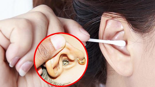 कान के मैल को कॉटन बड्स से साफ़ करना चाहिए या नहीं | कान के मैल को कैसे साफ़ करें | Boldsky*health