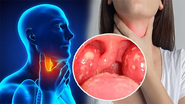 सर्दियों में गले में चुभन क्यों होती है | गले में चुभन का कारण | Boldsky *Health