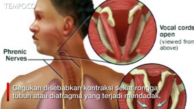 Cegukan seperti Sandiaga Uno? Ini Cara Mengatasinya