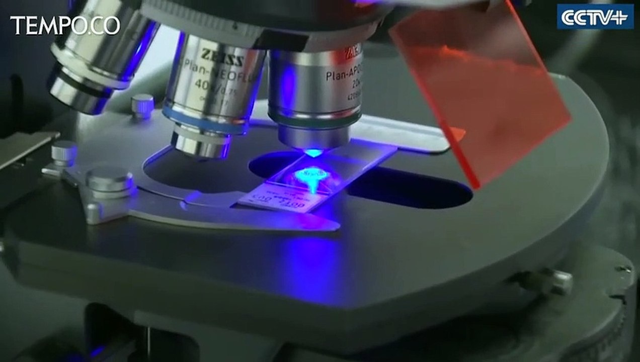 Uji Klinis Obat Baru bagi Penderita Alzheimer dari Cina