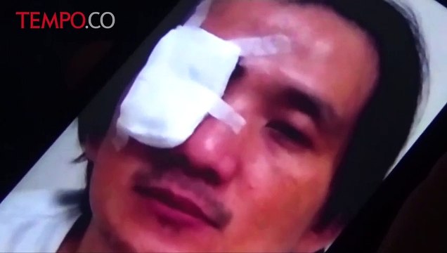 Seorang Warga di Makassar Jadi Korban Penyiraman Air Keras