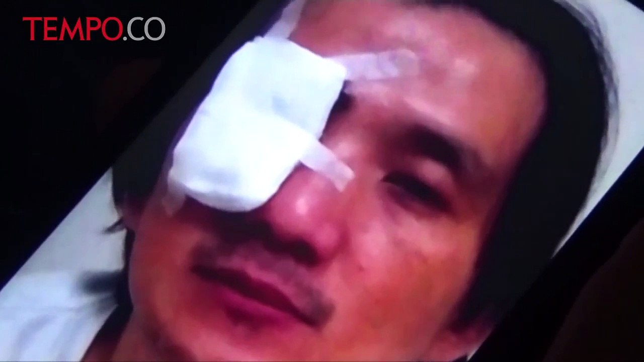 Mirip Kasus Novel, Usai Ibadah Malam, Mata Pria Ini Disiram Air Keras