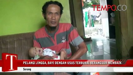 Pelangi Jingga, Bayi dengan Usus Terburai Berangsur Membaik
