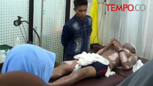 Korban Luka Bakar Akibat Ledakan Tabung Gas Dirawat Intensif