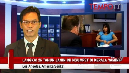 Langka-26-Tahun-Janin-Ini-Ada-di-Kepala-Yamini_1.flv