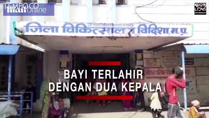 Langka, Bayi Terlahir dengan Dua Kepala, Tiga Lengan tapi Satu Tubuh