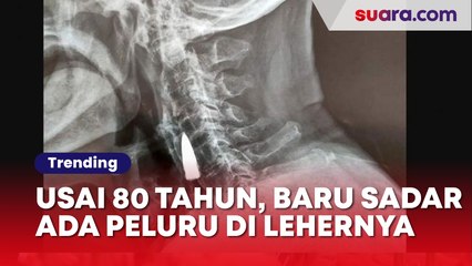Syok Sekaligus Ngilu! Usai 80 Tahun, Lelaki Ini Baru Sadar Ada Peluru Bersarang di Leher