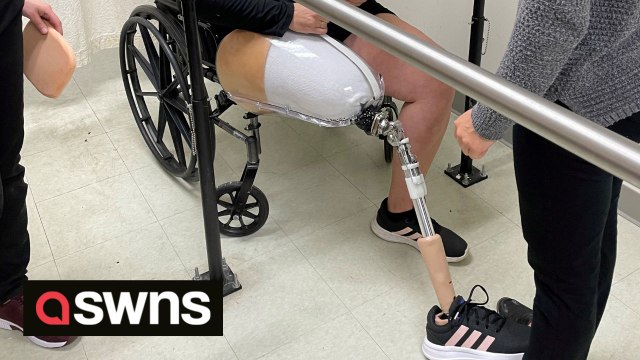 US mum who had leg amputated after tripping over in the garden has taken her first steps