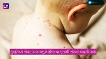 Measles Outbreak In Mumbai: मुंबईत गोवरच्या रुग्णात वाढ, मृतांची संख्या आठवर