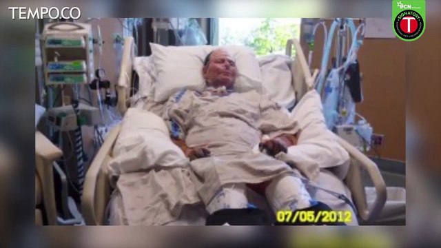 Benarkah Tangan Pria Ini Menghitam Karena Membakar Al Quran?