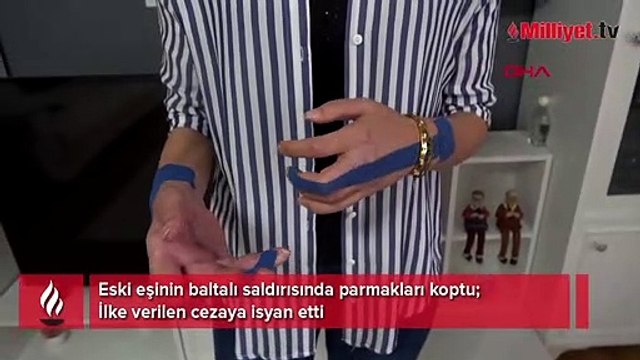 Eski eşinin baltalı saldırısında parmakları koptu! İlke verilen cezaya isyan etti