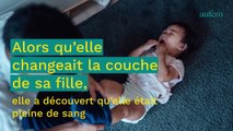 La couche de son bébé est pleine de sang, le diagnostic des urgences est très étonnant
