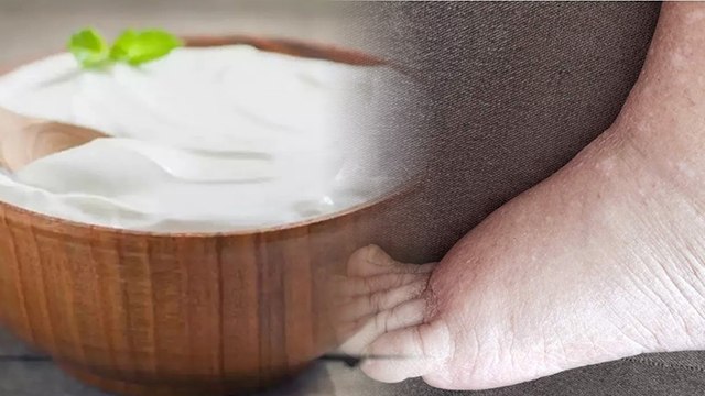 सर्दियों में दही खाना चाहिए या नहीं, दही खाने के नुकसान | Boldsky *Health