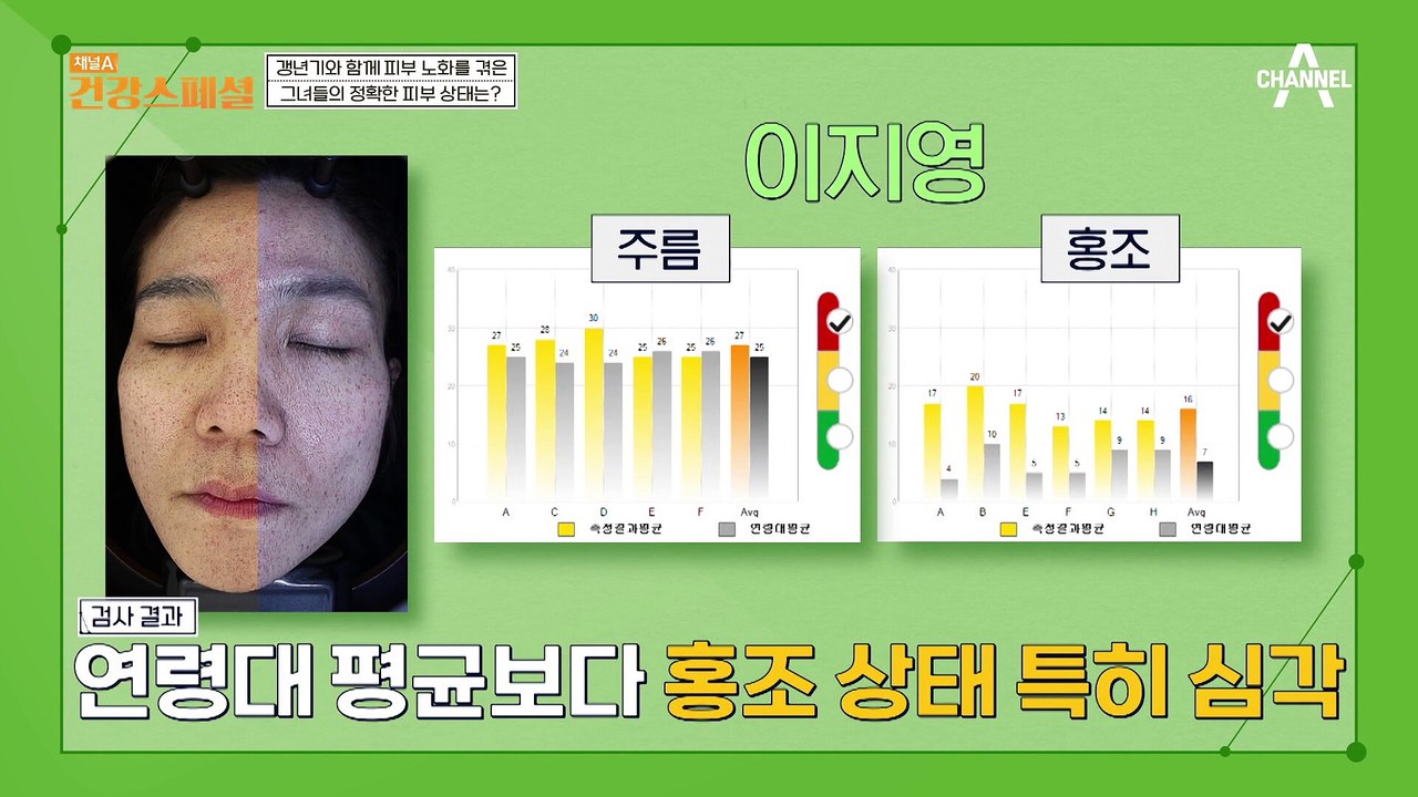 실제 나이보다 많은 피부 나이?! 갱년기와 함께 피부 노화를 겪은 중년 여성들