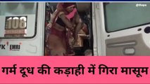 बांदा: दूध की कढ़ाई में गिरने से मासूम बच्चा झुलसा, ट्रामा सेंटर में कराया गया भर्ती