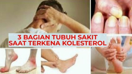 Waspada! Ini Tiga Bagian Tubuh Sakit saat Terkena Kolesterol tinggi