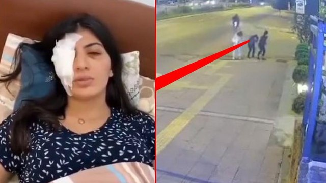 Motosikletten fırlatılan cisim üniversiteli kızın gözüne isabet etti