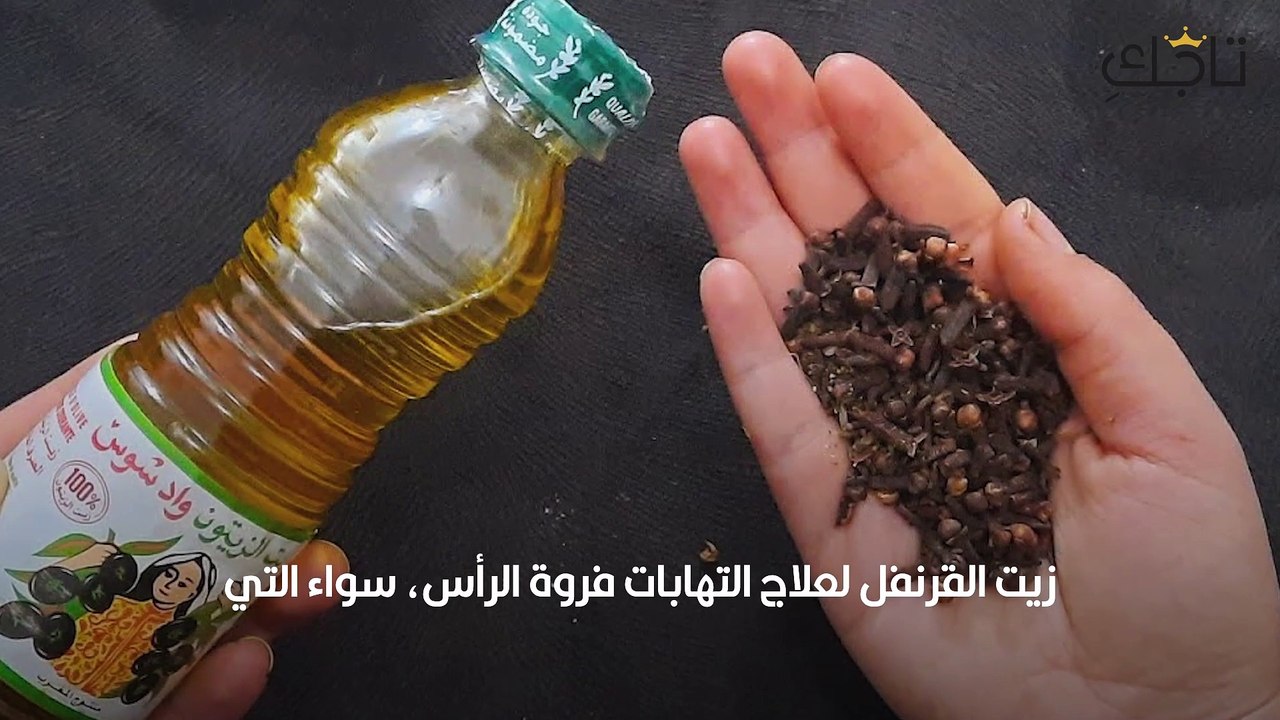 زيت القرنفل لالتهابات فروة الرأس