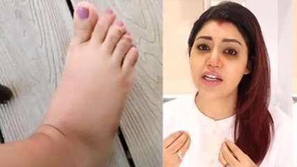 Debina Bonnerjee का Second Delivery के बाद हुआ ऐसा हाल,सूजे पैर दिखाकर बयां किया दर्द।*Entertianment