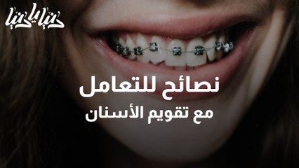 نصائح وتعليمات بعد تركيب تقويم الأسنان